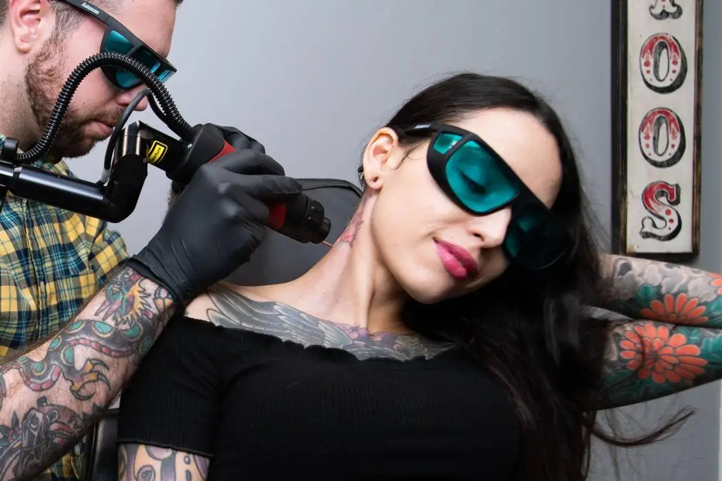 Tattoo Removal Near Me: What You Need to Know?